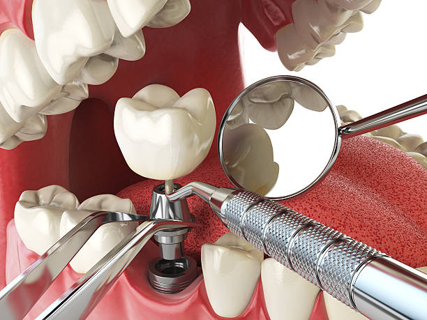 Best Mobile Emergency Dentist in Riverdale, GA